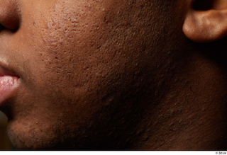HD Face Skin Canaan-Allvince Epps cheek chin face skin pores…